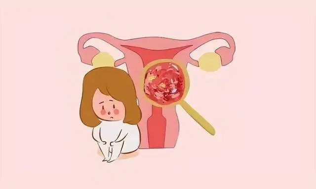子宫手术产伤身体剖腹肌瘤吗_剖腹产和子宫肌瘤手术_子宫肌瘤手术比剖腹产伤身体吗